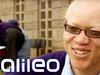 Albinos in Afrika | Galileo | ProSieben - {channelnamelong} (Super Mediathek)