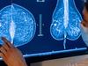 NANO vom 19. April 2024: Mammographie-​Screening wird ausgeweitet - {channelnamelong} (Replayguide.fr)