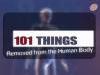 101 Things Removed From The Human Body - {channelnamelong} (Youriplayer.co.uk)